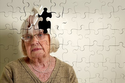 picture of a Dementia patient